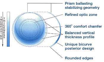 Soflens Toric