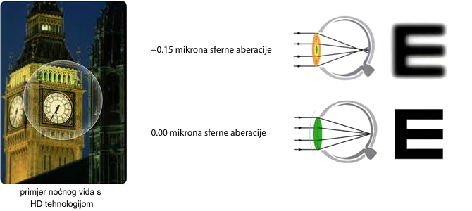 Sferna aberacija